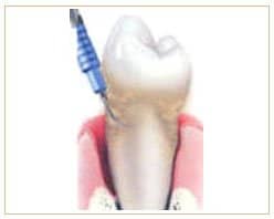 Slider image (3) Bangkok Dental Image